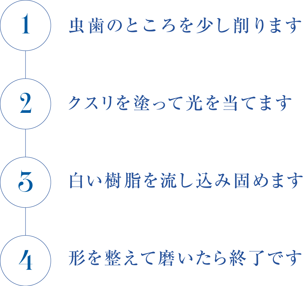 虫歯治療の流れ